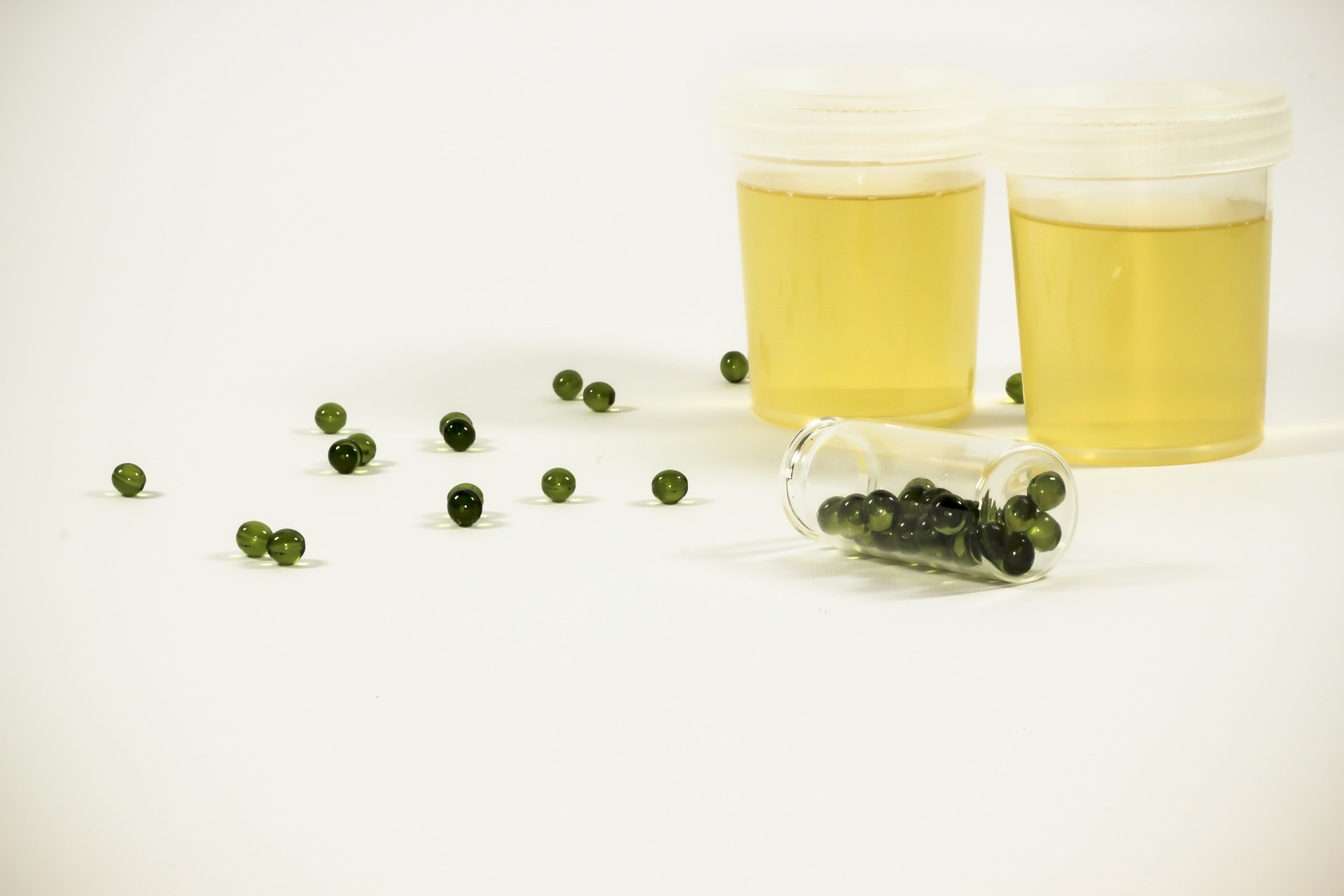 9 Signs and Symptoms of Urinary Tract Infection