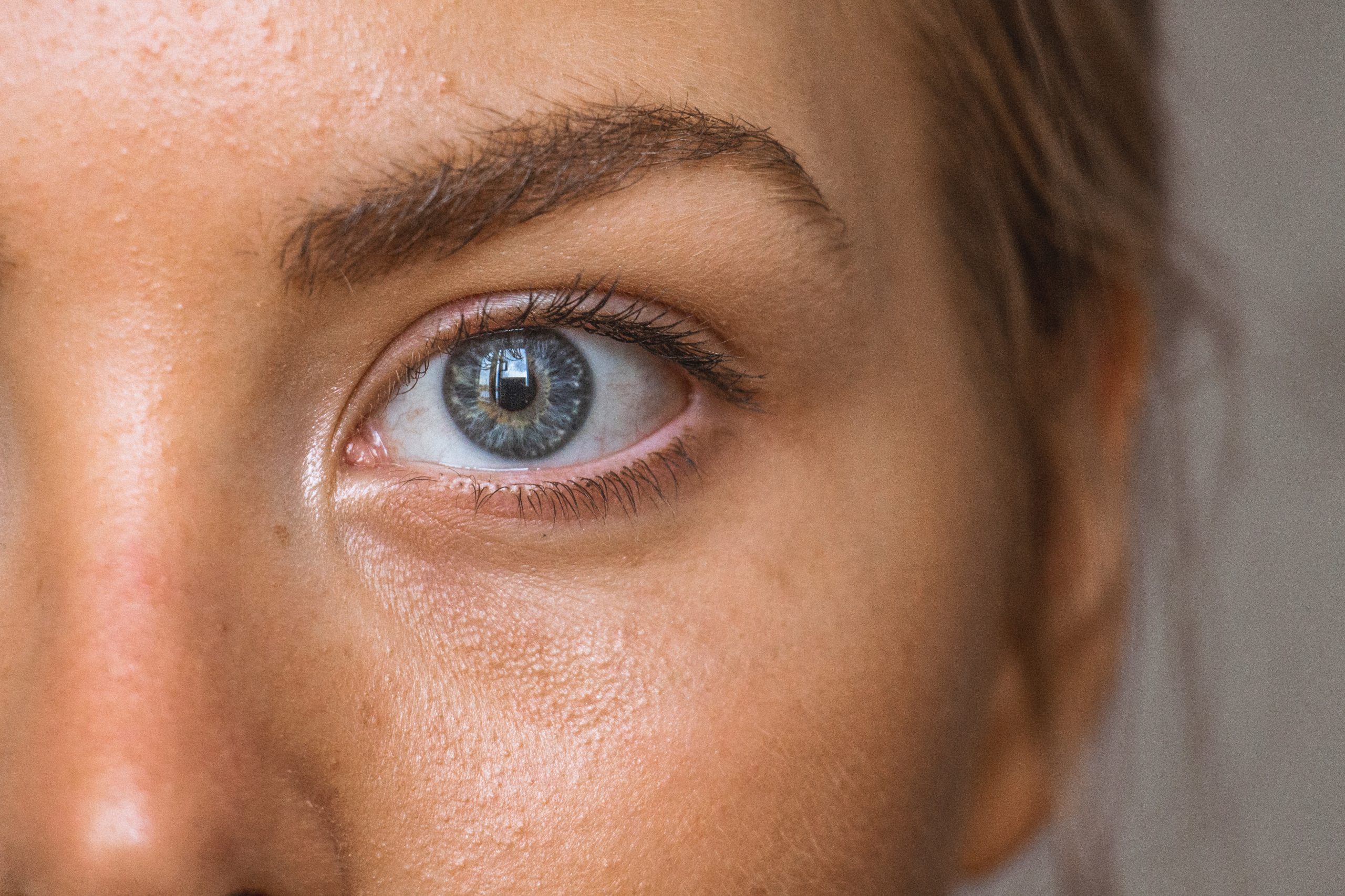 Prevention Of Glaucoma