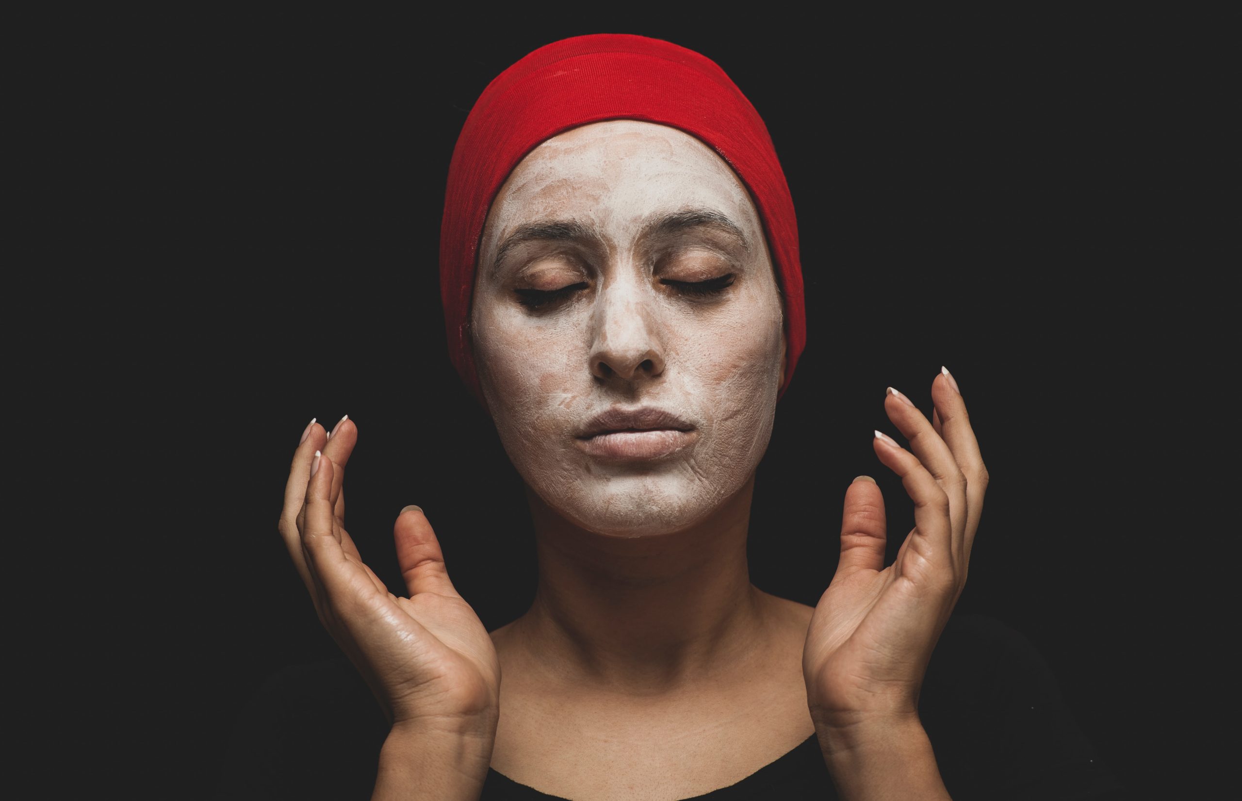 Rosacea Treatment