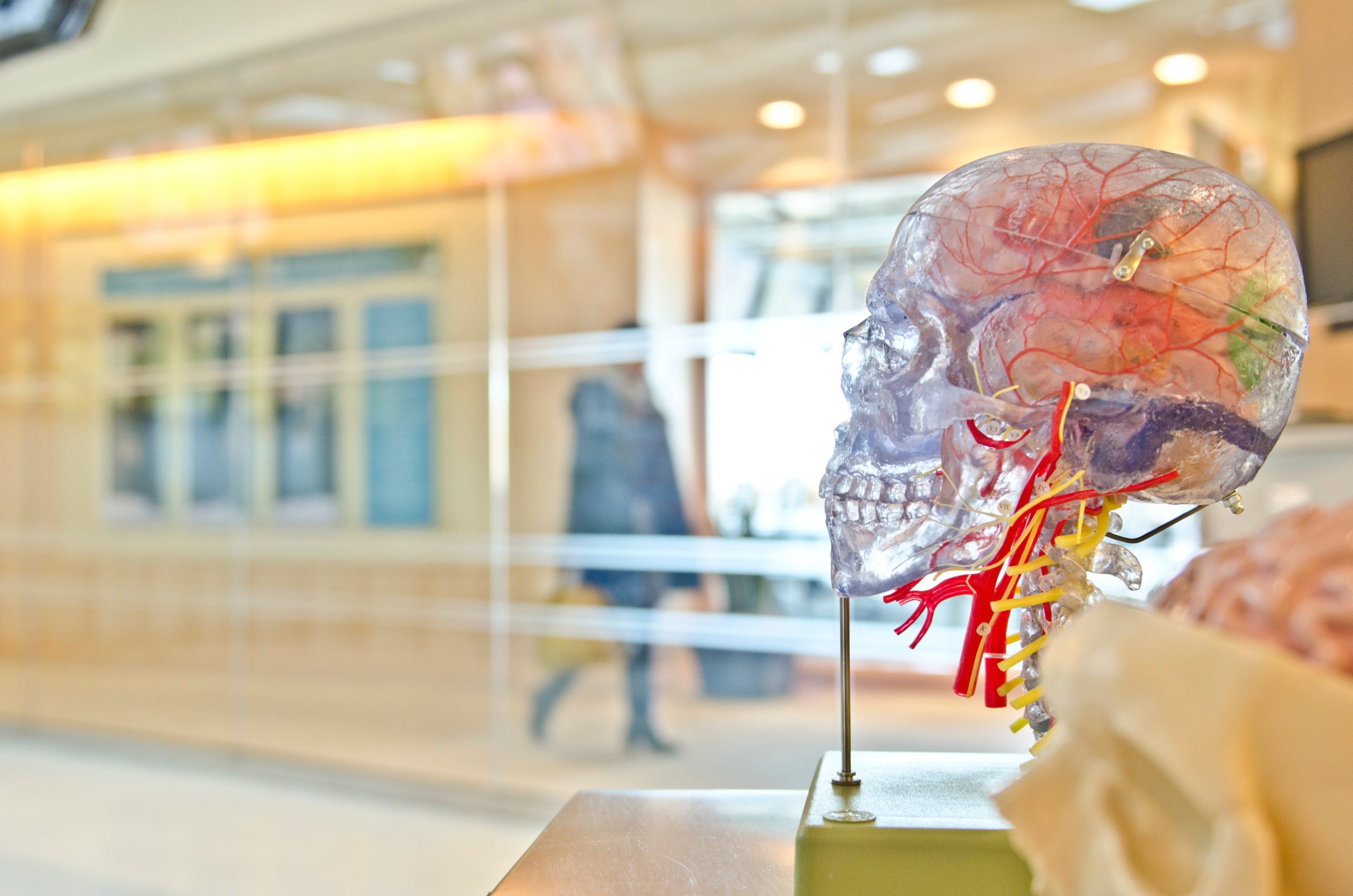 Trigeminal Neuralgia Diagnosis