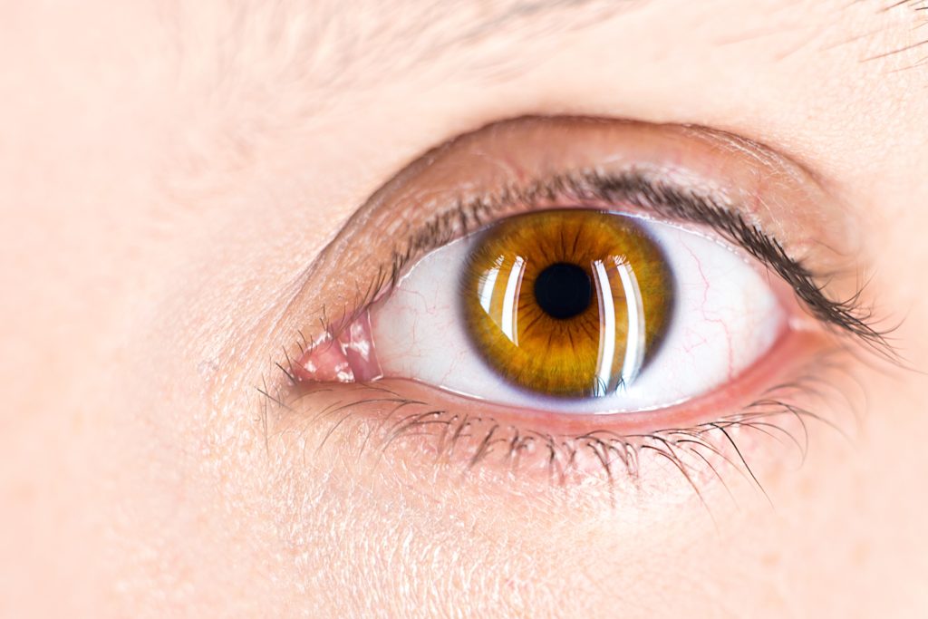 What Are Some Common Retinal Detachment Symptoms