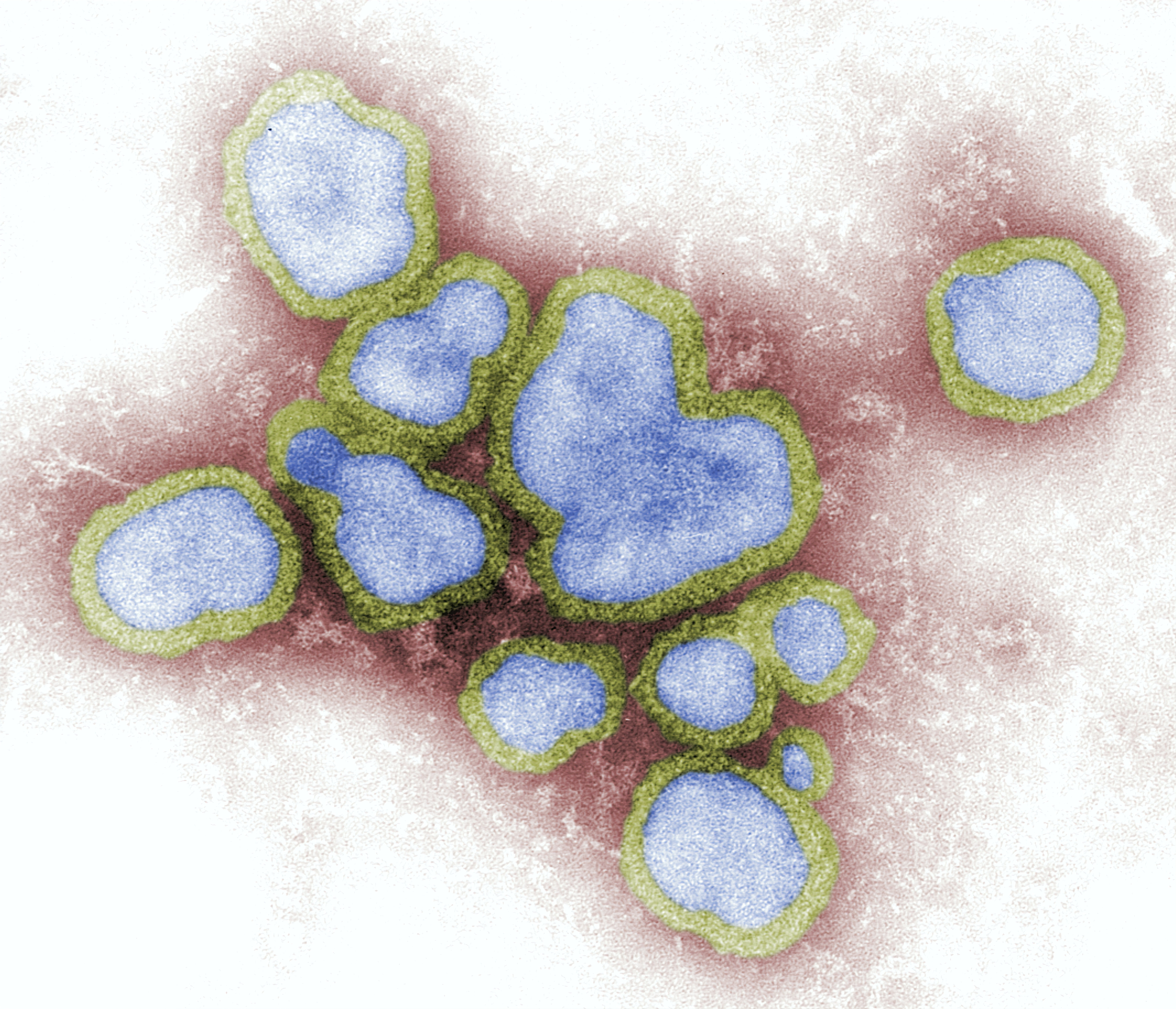 The Spread Of The Spanish Flu In 1918