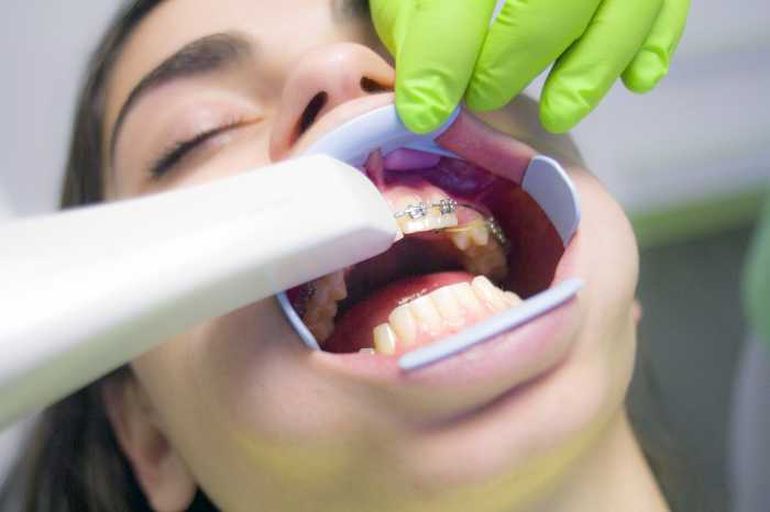 7 Symptoms of Salivary Gland Cancer