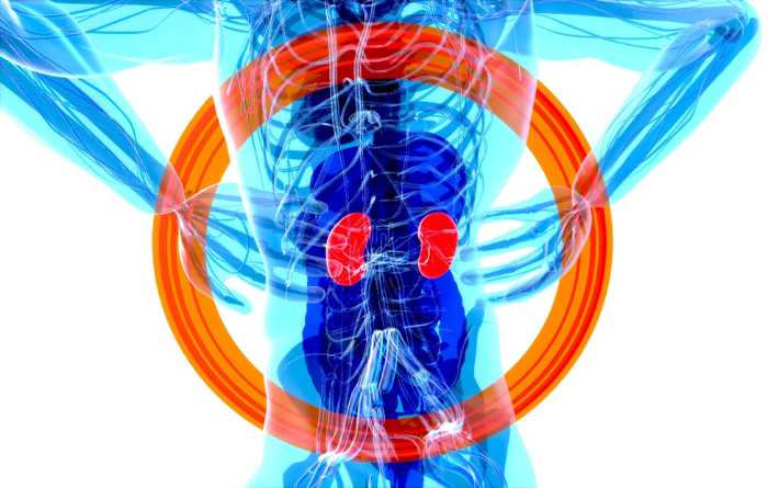 treatments for kidney cysts