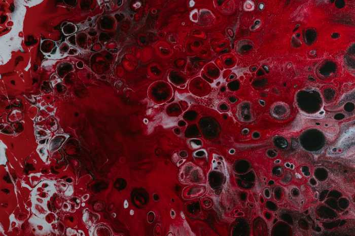 blood clot in the leg symptoms