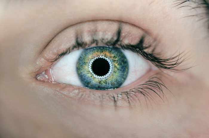 eye floaters inflammation