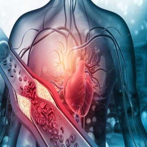 ALL ABOUT CALCIUM CHANNEL BLOCKERS