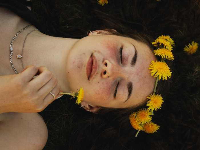 symptoms of lichen sclerosus