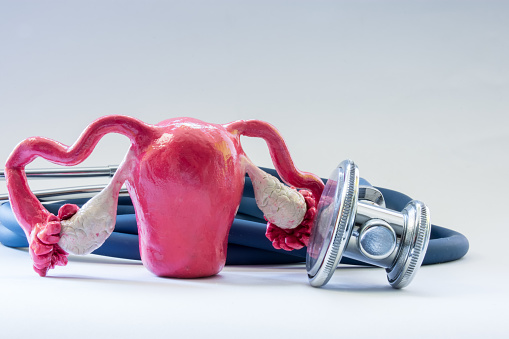 symptoms of uterine fibroids