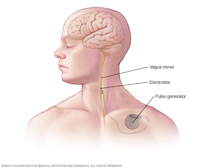 vagus nerve