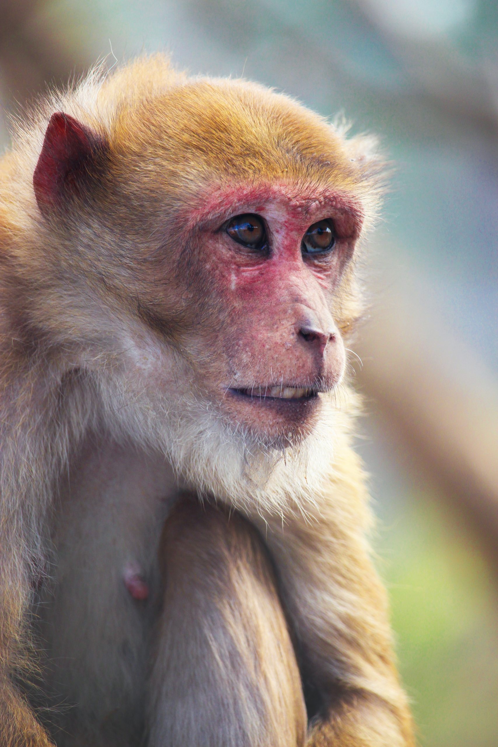 Everything You Need to Know About Monkeypox