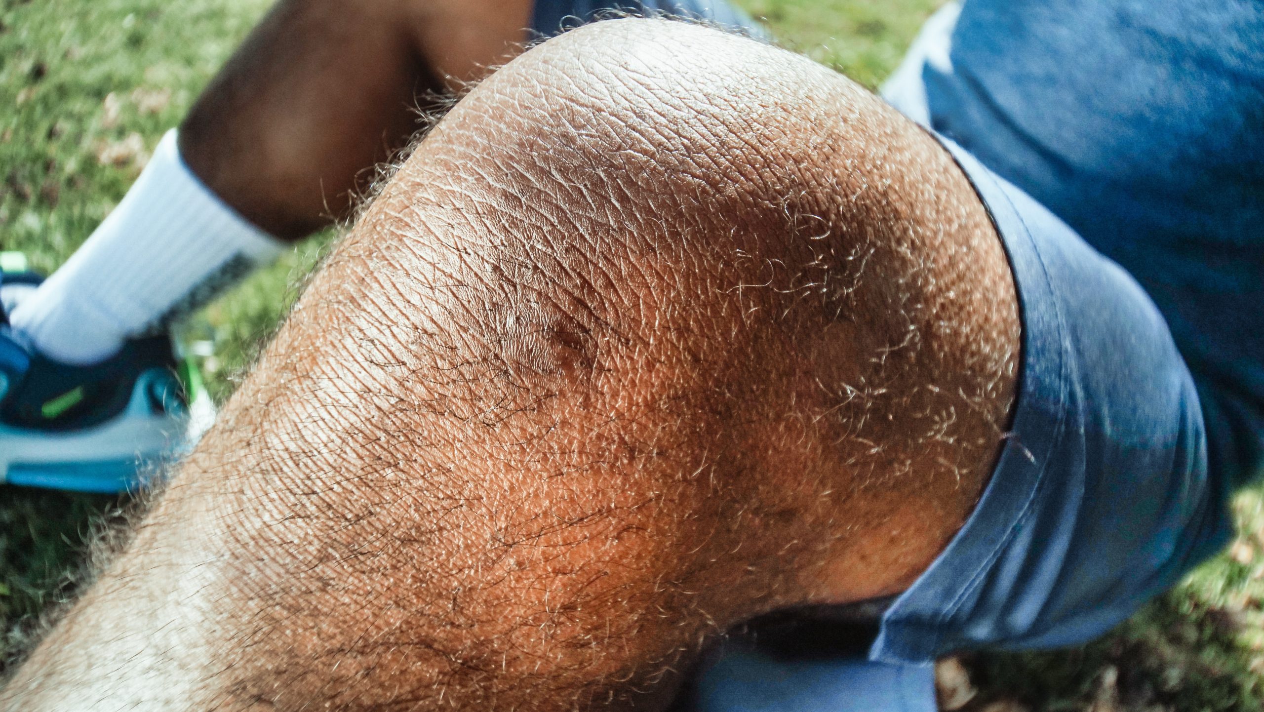 Symptoms And Treatments Of Pseudogout