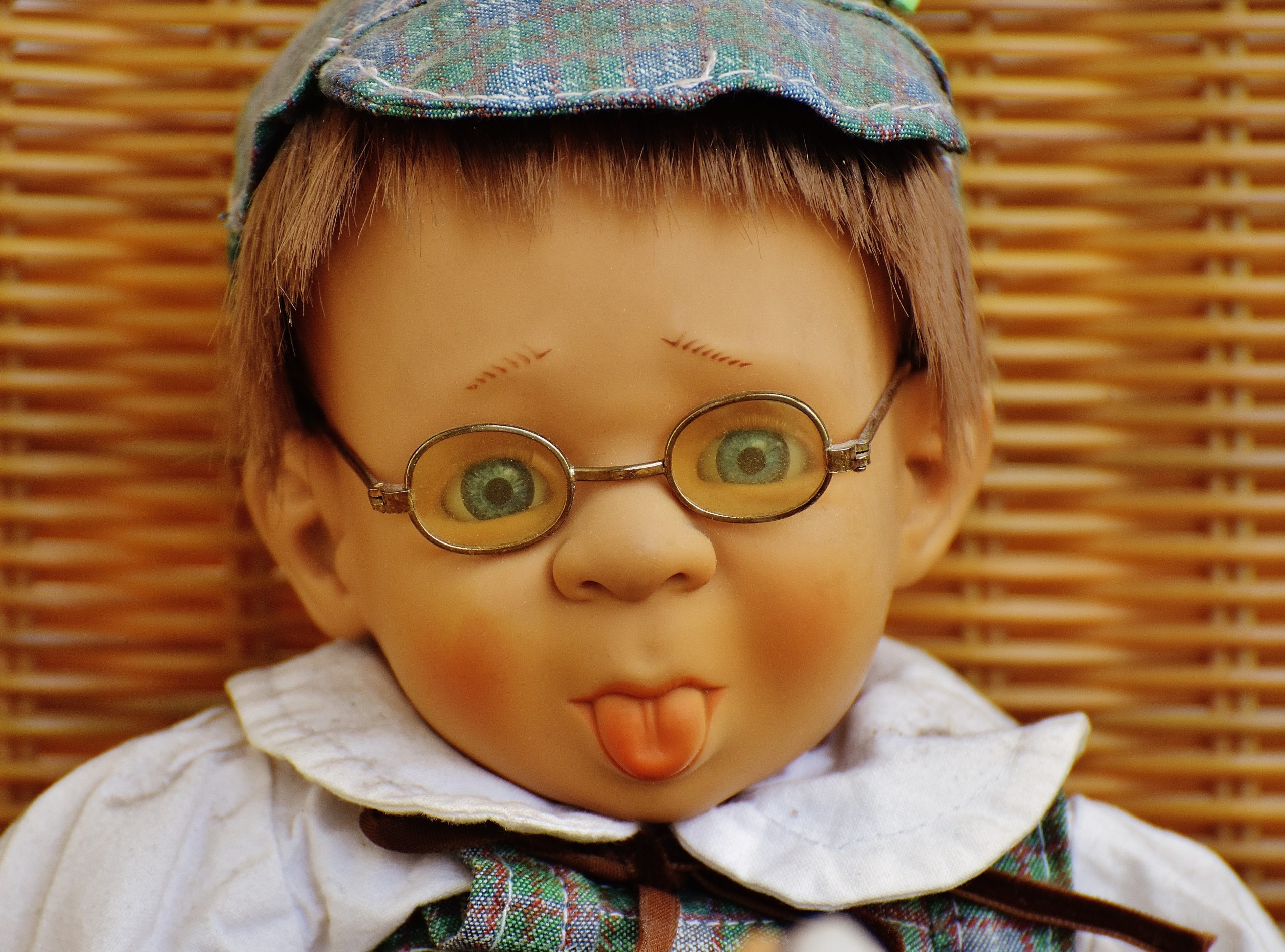 What is Ankyloglossia?